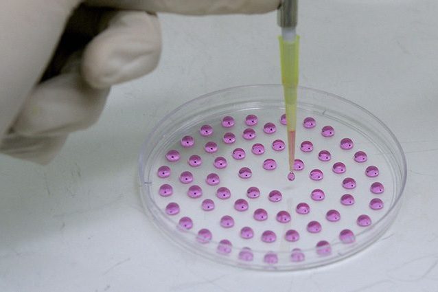 Sclerosi multipla, speranze per la nuova sperimentazione italiana con cellule staminali