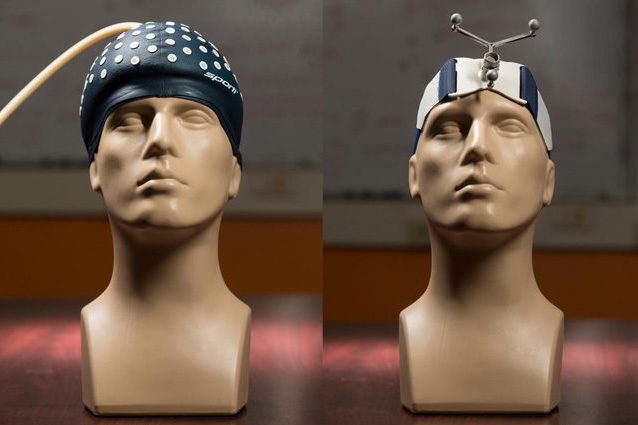 Perché sei sacche di caffè aiutano i medici durante le operazioni chirurgiche alla testa