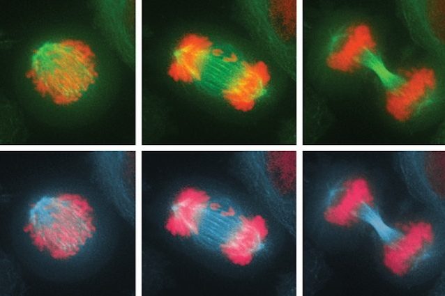 Eliminare le cellule potenzialmente cancerose? La scoperta dello scienziato Santaguida del MIT