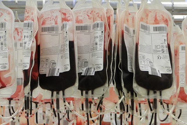 Porfiria e vampiri, cos'è la malattia del sangue che spiega la nascita del mito
