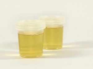 Elettricità dall'urina, la nuova biotecnologia per purificare lo scarico dai batteri