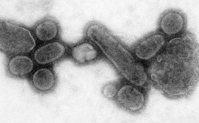 Il ceppo dell'influenza spagnola ricostruito in laboratorio: credit wikipedia