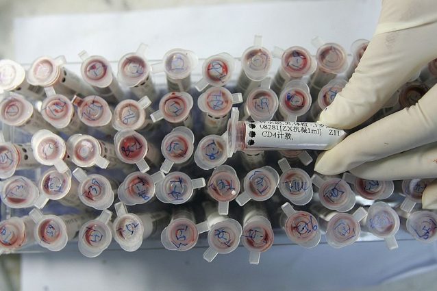 Cancro, dai ricercatori italiani le nanoparticelle ingegnerizzate: diagnosi rapida e low cost