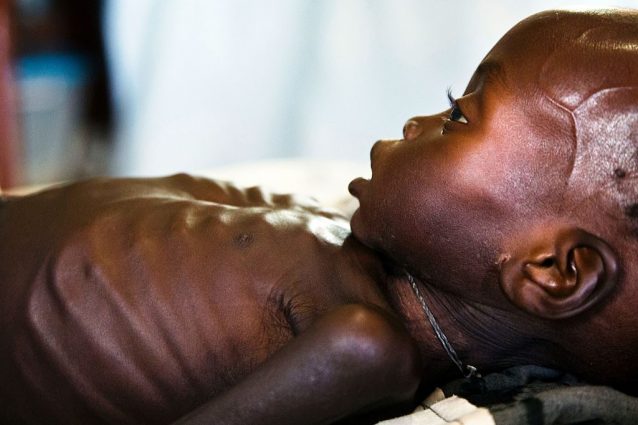 Fame nel mondo, torna a salire il numero di persone malnutrite: non accadeva da 10 anni