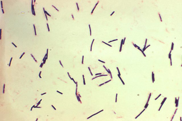 Clostridium perfringens: credit wikipedia