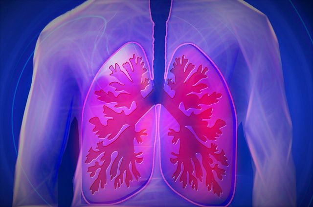 Cancro al polmone, addio a chemioterapia per il 40% dei pazienti sempre più vicino