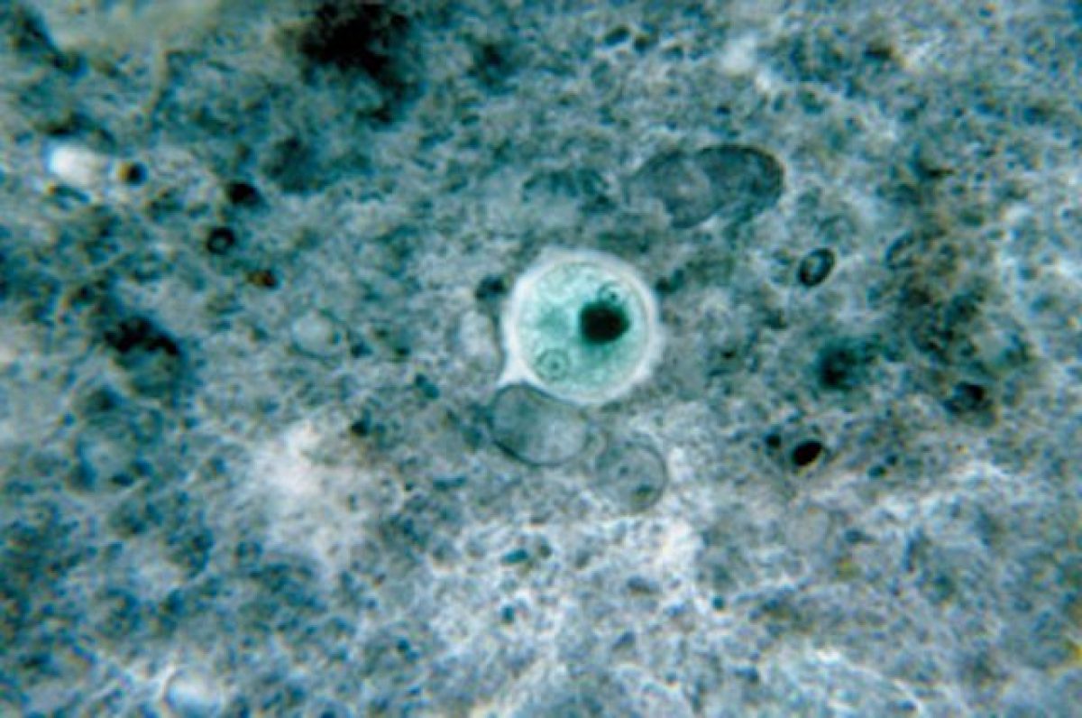 endolimax nana sintomi endolimax nana sintomi