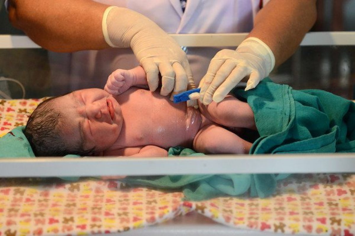 Cordone ombelicale cos'è, perché donarlo e quali malattie può curare