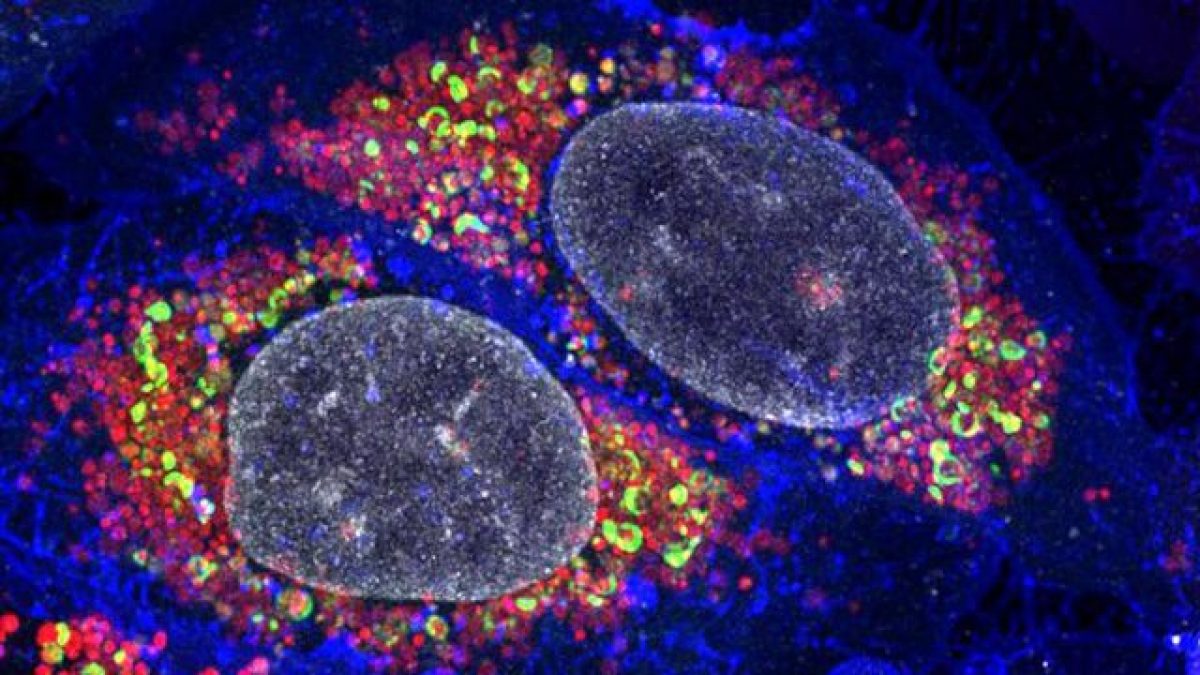 Credit: Padman/Monash Micro Imaging