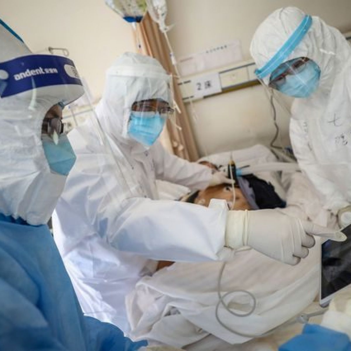 “CLOROCHINA GUARISCE DAL CORONAVIRUS”