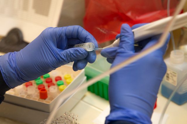 Per la prima volta corretta la fibrosi cistica in cellule umane grazie all'editing genetico - Vimarsana News