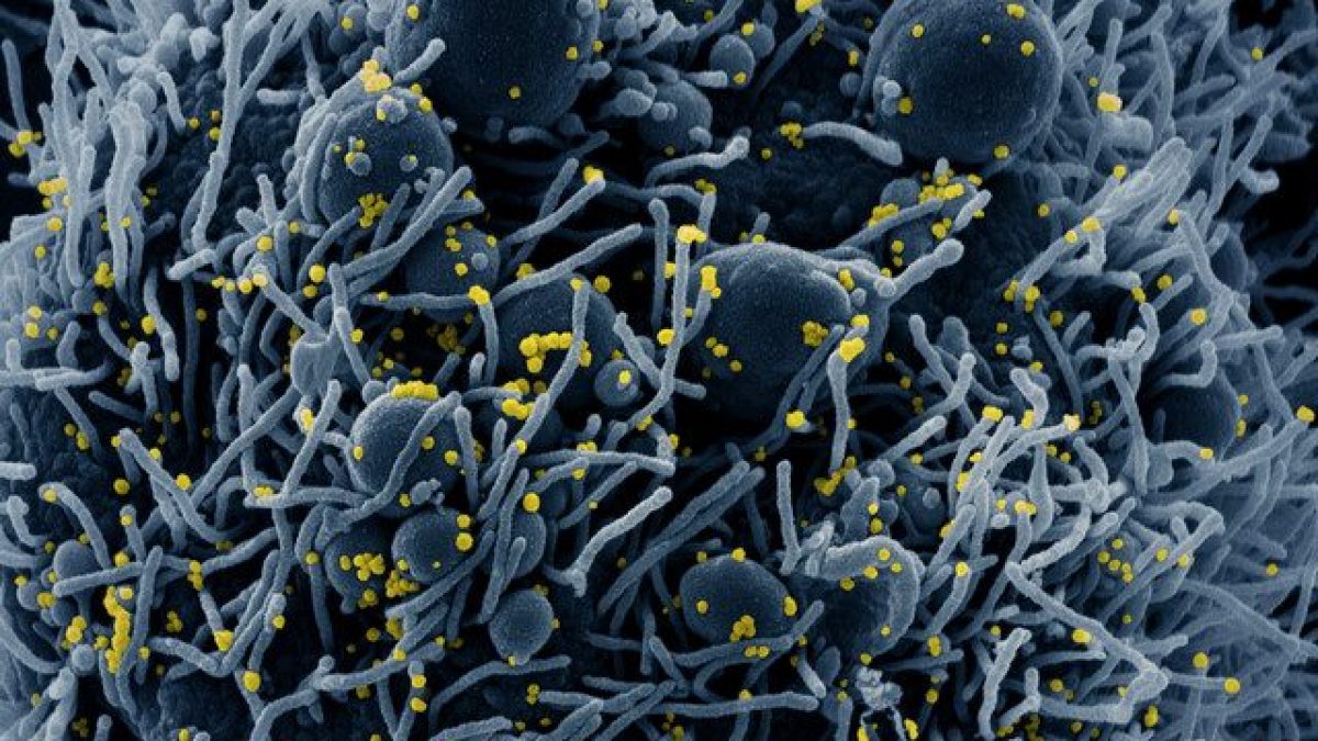 Particelle virali del coronavirus su cellula umana (in giallo). Credit: NIAID
