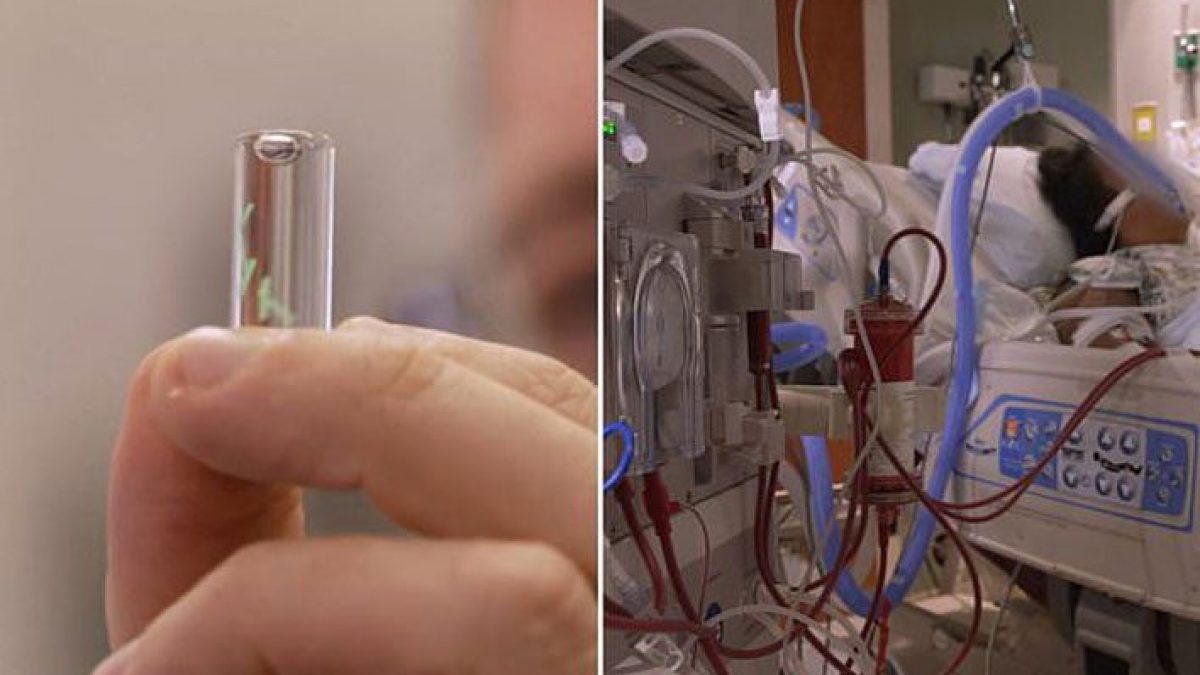 a sinistra, il microchip sottopelle contenuto in un gel verde, simile a un tessuto / 60 Minutes