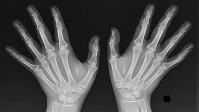 biohacking