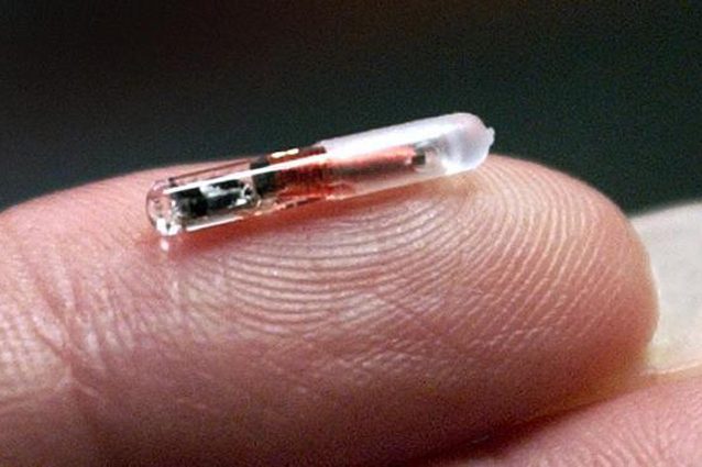Un chip sottopelle per monitorare i dipendenti al lavoro (e le loro pause)