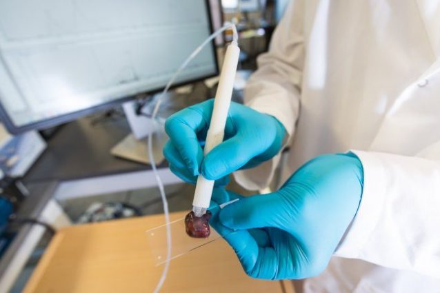 MasSpec Pen, la "penna" in grado di riconoscere un tumore in 10 secondi