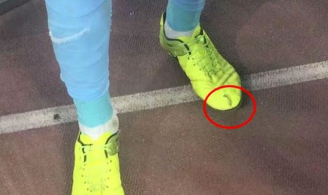 La scarpa cucita di Ramires (fonte sportnewstoday.net)